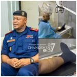 EXCLUSIVITÉ – Marche du 15 septembre à Kinshasa : le général Israël Kantu Bakulu hospitalisé après une blessure à la jambe